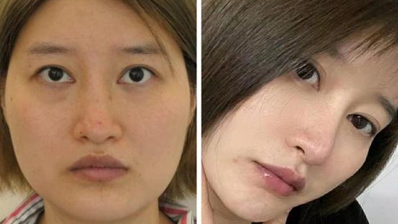成都注射美容加盟代理，揭秘成功之道