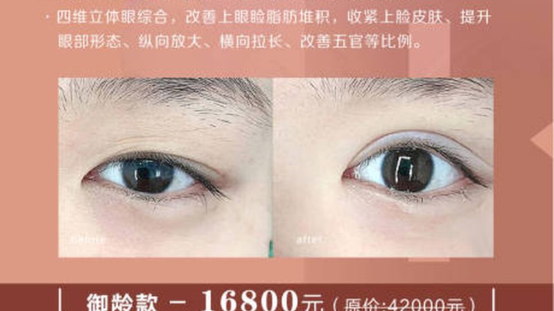 轻医美项目代理公司：揭秘行业背后的秘密