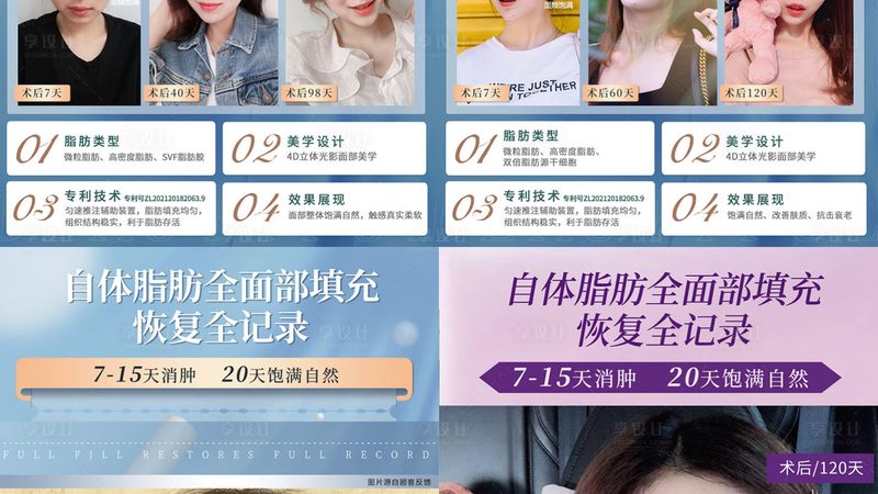 正规肉毒素批发厂家