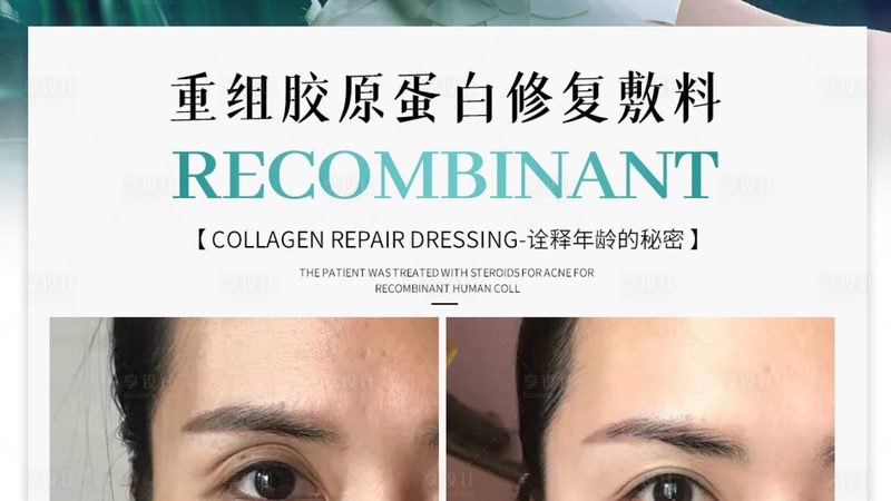 玻尿酸耗材批发价格：揭秘背后的因素与选择要点