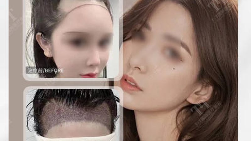 上海整形美容术前流程：揭秘术前准备的关键步骤