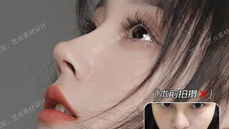 膨体隆鼻假体：揭秘其价格背后的秘密