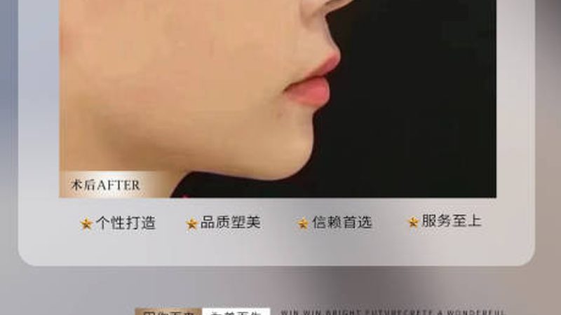 吸脂手术，价格之外，你还需要了解这些