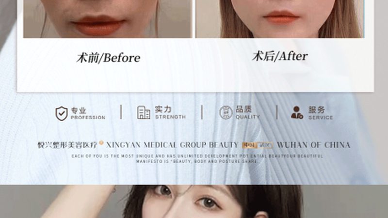 医美加盟注意事项