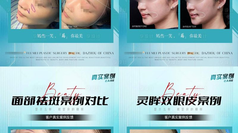 沈阳韩式双眼皮：效果持久的关键因素