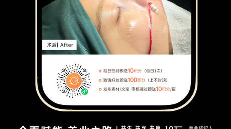 揭秘北京正规医美医院水光针报价：不只是价格，更看技术与服务