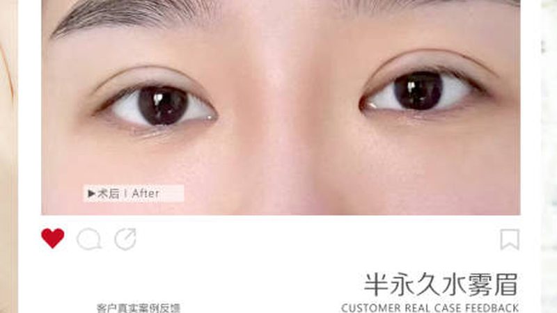 成都皮肤管理榜单背后，消费者该相信什么