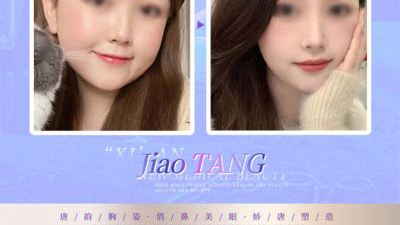 面部注射美容，效果维持时间揭秘