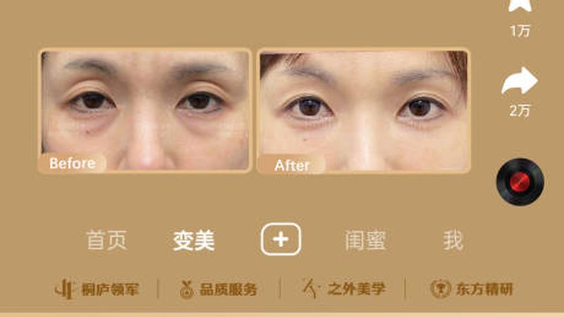 皮肤管理店如何通过精细化管理实现降本增效