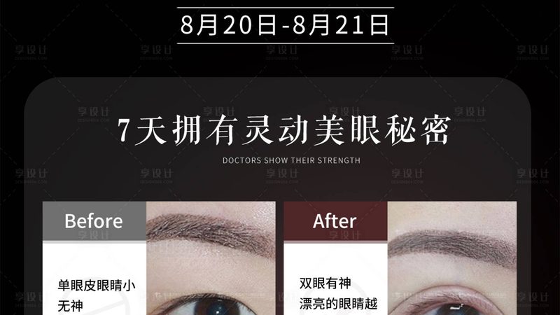 埋线提升线材，出厂价与零售价差多少的真相**